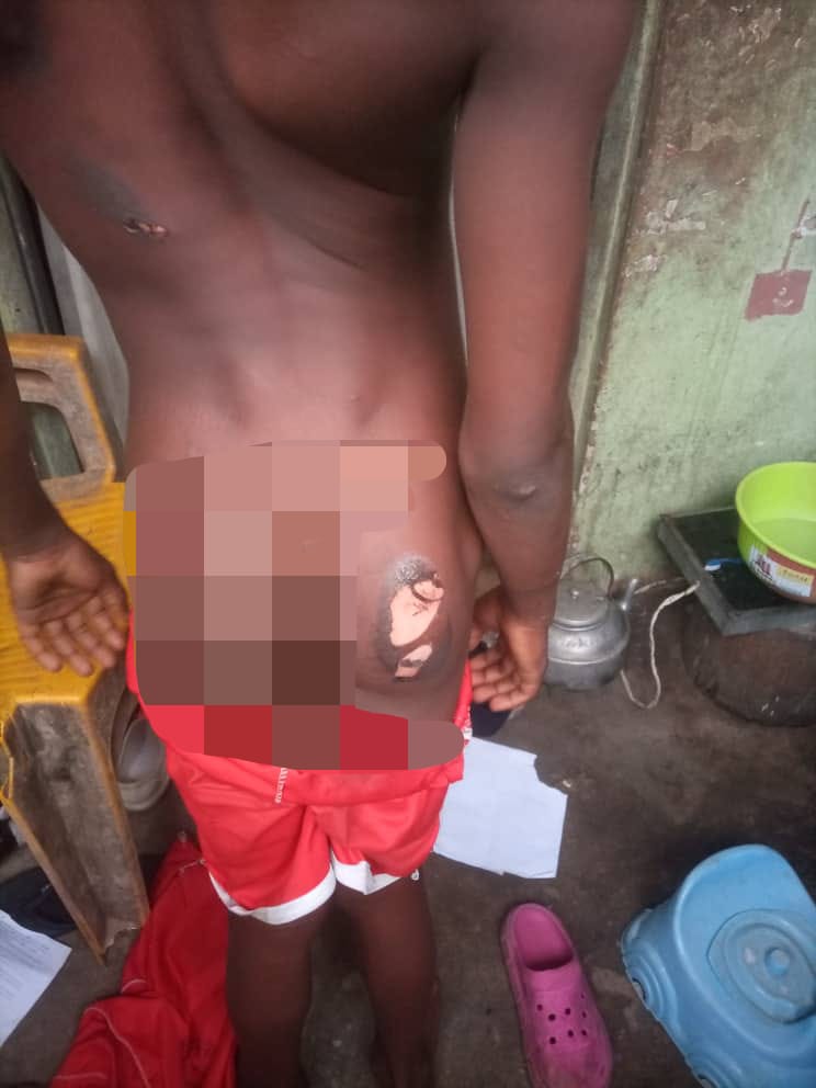 10-year-old Precious Daniel Offiong abused by his stepmother, Mrs Mary Ita Edet