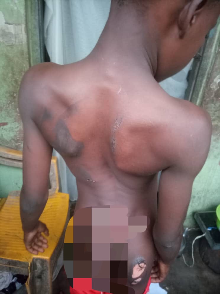 10-year-old Precious Daniel Offiong abused by his stepmother, Mrs Mary Ita Edet