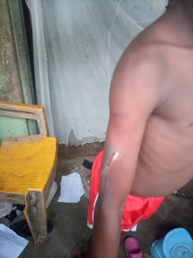 10-year-old Precious Daniel Offiong abused by his stepmother, Mrs Mary Ita Edet