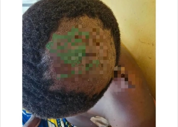 19-year-old girl stabs boyfriend for allegedly cheating on her