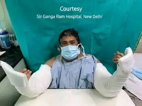 India records first successful hand transplant