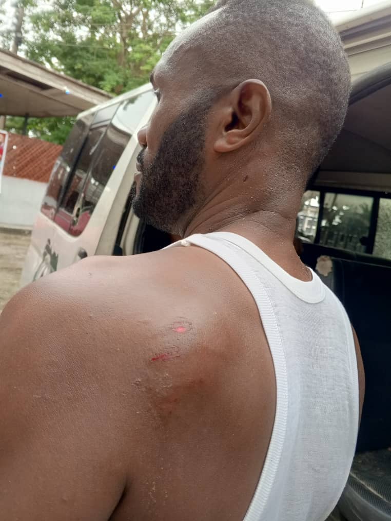 Hoodlums attack palliative-ladened NUJ bus, injure journalist, others in Cross River