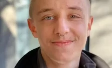 Man Pursues Reptilian Transformation by Weekly Silicone Skull Injections