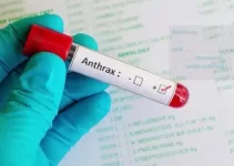 FG Warns Nigerians About Anthrax Outbreak in Zamfara