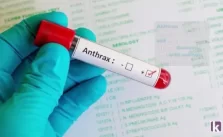 FG Warns Nigerians About Anthrax Outbreak in Zamfara