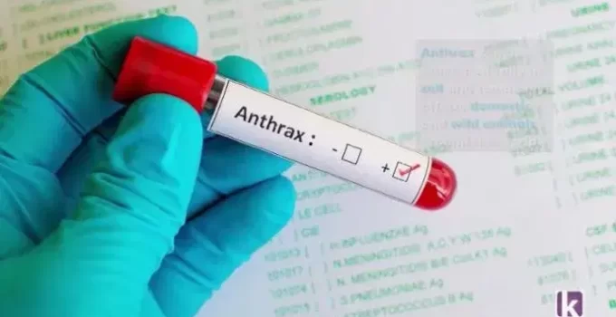 FG Warns Nigerians About Anthrax Outbreak in Zamfara