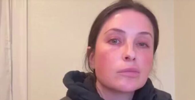 Bristol Palin Diagnosed with Bell's Palsy, Faces Temporary Facial Paralysis