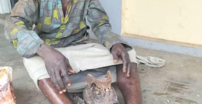 Man Arrested with Human Skull in Ogun