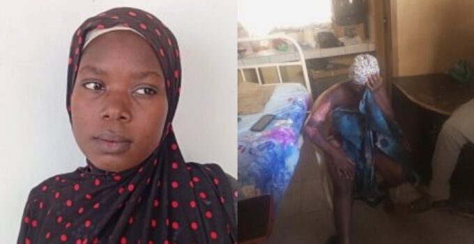 Pregnant Woman in Labor Scalded with Hot Water by Sister-in-Law in Adamawa