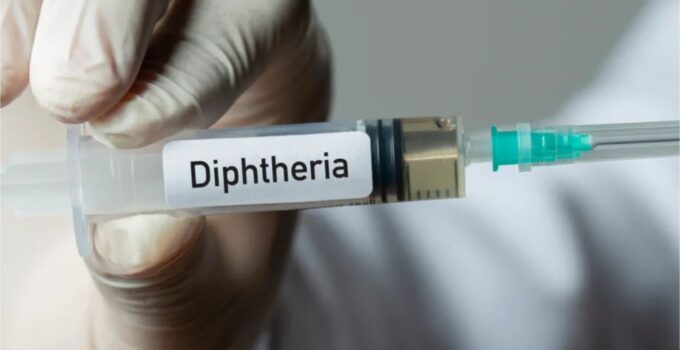 Nigeria Reports 41,000 Cases of Diphtheria