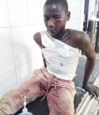 Survivor of Abuja School IED Blast Taken into Custody at Hospital