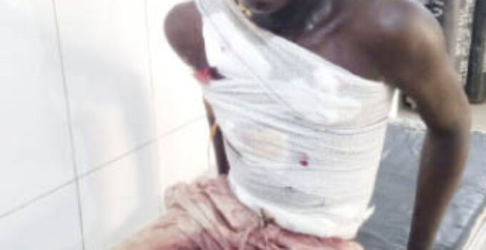 Survivor of Abuja School IED Blast Taken into Custody at Hospital