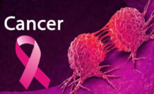 Japa: A Single Doctor Caring for Over 1,800 Cancer Patients - Nigerian Cancer Society