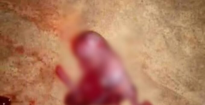 Fetus Discovered Abandoned in Rivers