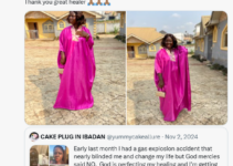 Nigerian Burn Survivor Shares Recent Photos Months After Narrow Escape from Gas Explosion that Nearly Caused Blindness