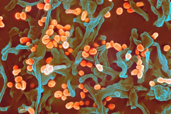 Lassa fever virus Major Health Stories Across Nigeria (March 2025 Edition)
