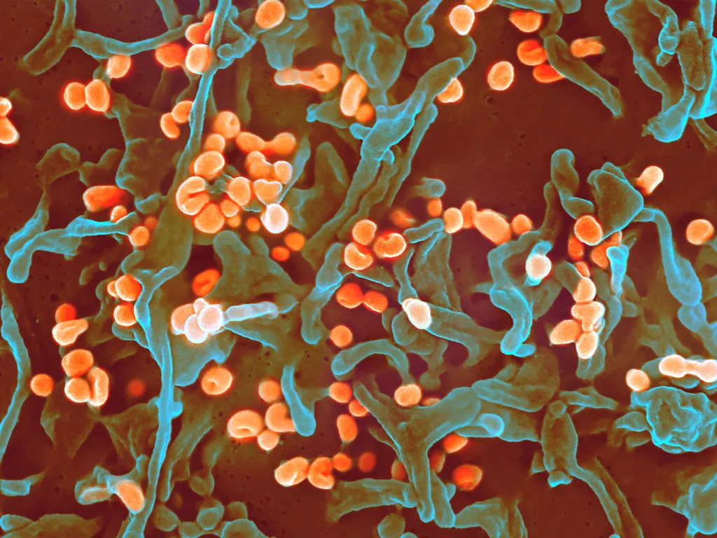 Lassa fever virus Major Health Stories Across Nigeria (March 2025 Edition)