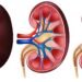 10 ways to keep your kidney healthy — Dr Daniel Otokpa