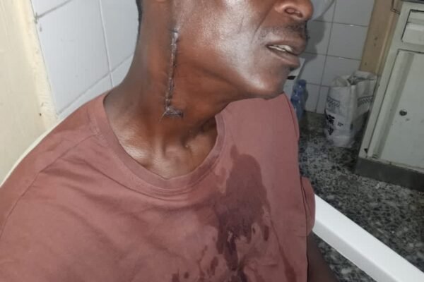 3fcc6f1d 9929 44d8 bbc1 3ab5bd995f92 March 23 Police Shooting: Survivor Alleges Neglect