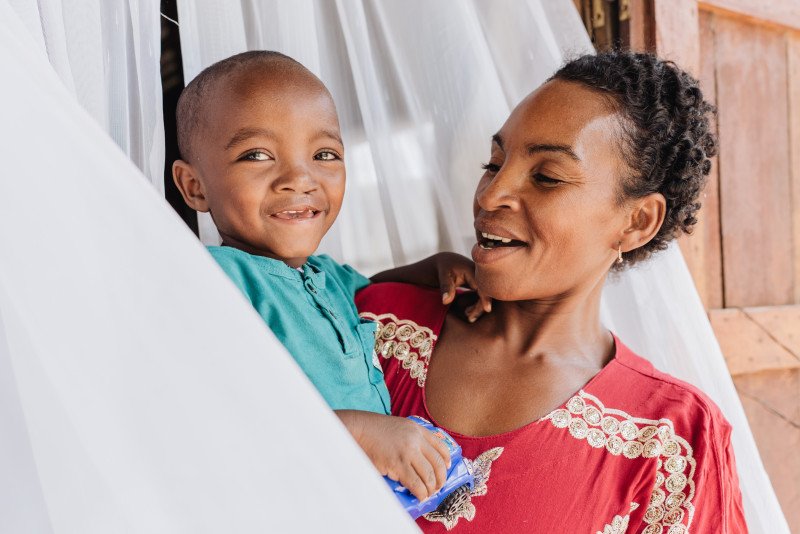 3-year-old Armane Madagascar boy now smiles without shame