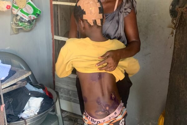 IMG 2160 scaled 1 Tragedy in Ekorinim: Five Year Old Boy Dies in Flood, One Survives