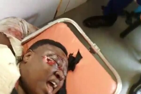 NSCDC female officer crushed by van VIDEO: NSCDC vehicle crushes female officer during show of force