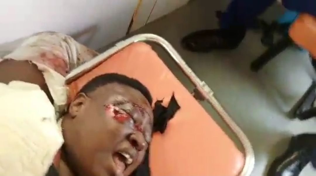 NSCDC female officer crushed by van VIDEO: NSCDC vehicle crushes female officer during show of force