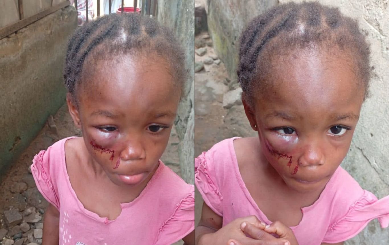 Edidiong Uwem Aniefiok Ekpene Police arrest woman for allegedly brutalising 5-year-old niece in Calabar