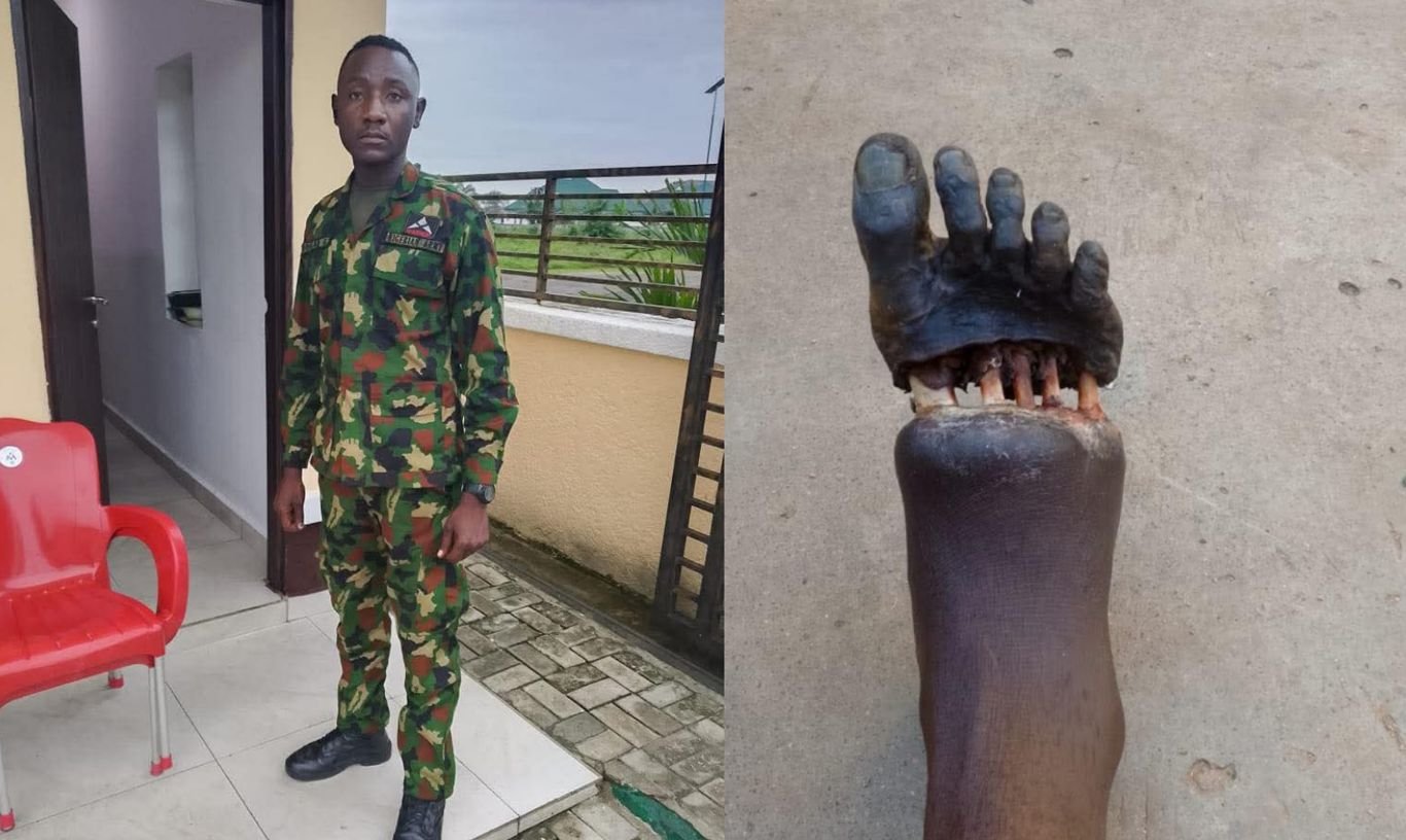 Wounded Nigerian Soldier Umar Nigerian soldier's grievous foot injury sparks sacrifice debate