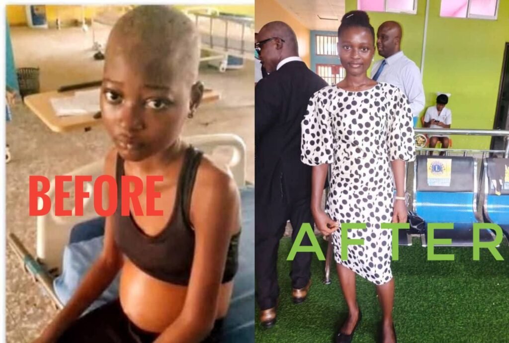 Tabot Genta Celebrations as 18-Year-Old Beats Stage 4 Cancer at UTCH