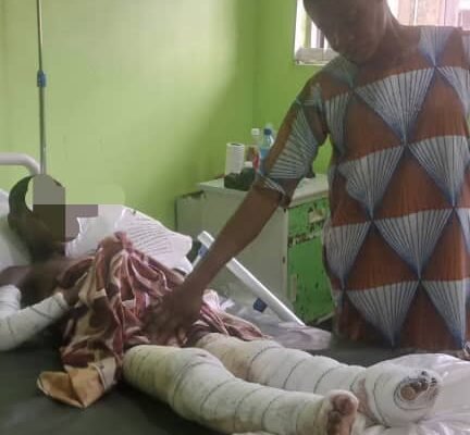 Happiness Ekere SOS: Father of 7-year-old Calabar gas explosion victim cries for help; Cross Riverians beg First Lady to save the little girl's life