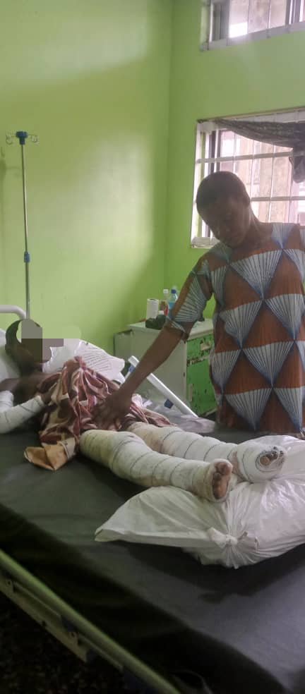 Happiness Ekere SOS: Father of 7-year-old Calabar gas explosion victim cries for help; Cross Riverians beg First Lady to save the little girl's life