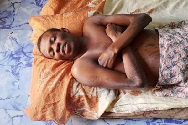 Cross Riverian paralysed for 23 years appeals to Governor Otu, First Lady for help