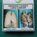 NTCA urges Nigeria to reject tobacco industries development initiatives